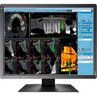 Монітор EIZO MX216-SB в Notebooker.ua